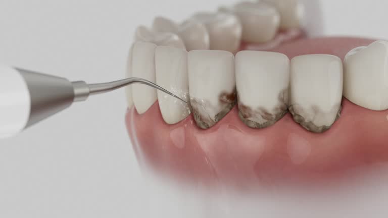 Trusted Dental Crowns And Bridges service in Brady, TX - Dentist Open Now